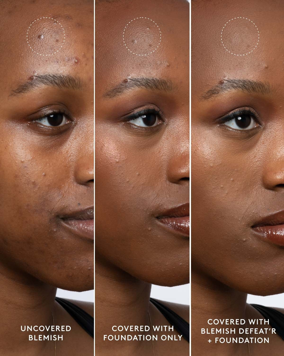 Blemish Defeat'r BHA Spot-Targeting Gel