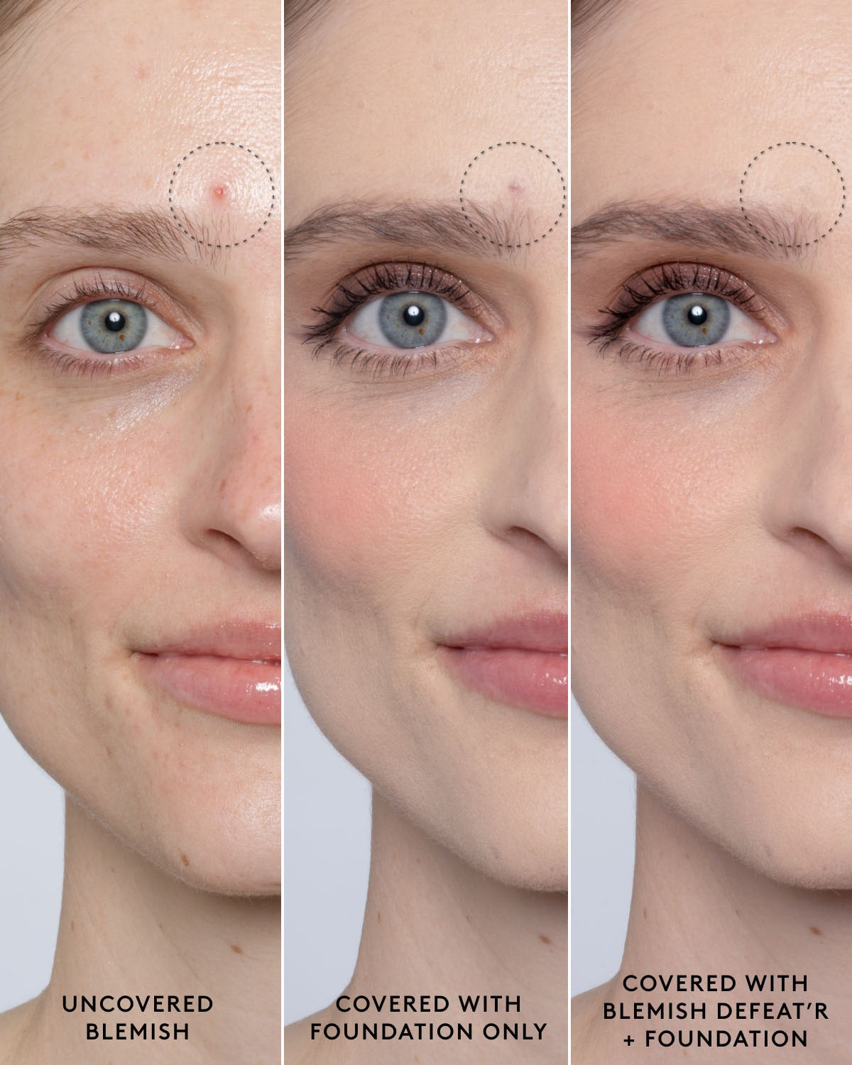 Blemish Defeat'r BHA Spot-Targeting Gel